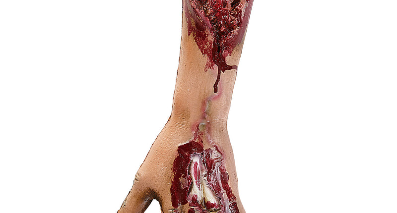 Afgehakte onderarm met bloed