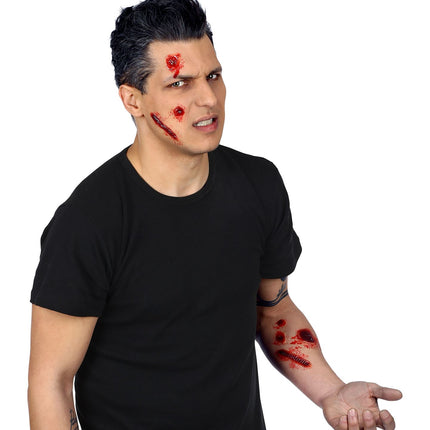 Widmann SRL Nep brand-wonden-set